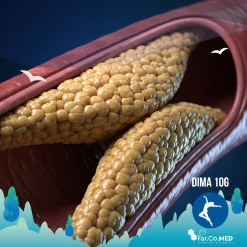 Dieta chetogenica e colesterolo, una fotografia iperrealistica e dettagliata di un'arteria umana che mostra un significativo accumulo di placca di colesterolo giallastra all'interno, con una prospettiva angolata che ne enfatizza l'ostruzione. L'illuminazione drammatica crea contrasti e mette in risalto la texture della placca, mentre il tessuto arterioso circostante appare sano.